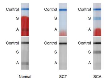 Fig.1 Diagram of several blood test strips.