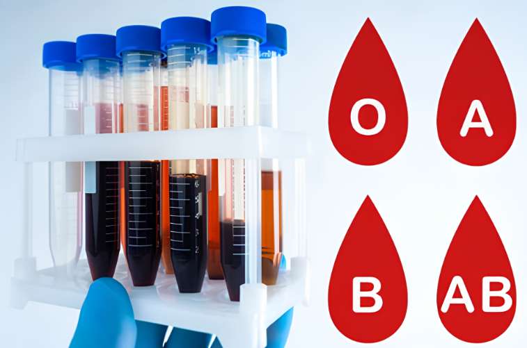 The schematic diagram of the blood type analyzer.