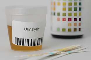 The schematic diagram of urinalysis.